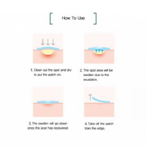 لصقات المعجزة 30 يوما لعلاج الحبوب والآثار من سوم باي مي – 18 قطعة لاصقة