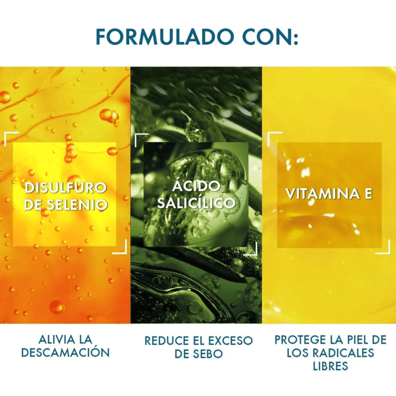 شامبو ديركوس ضد القشرة للفروة الحساسة من فيتشي- 200 مل