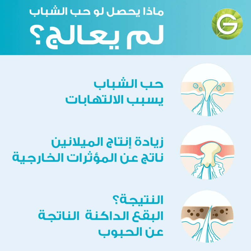 غارنييه سيروم سكين اكتيف تنقية سريعة للبشرة المعرضة لحب الشباب بحمض الساليسيلك - 15مل